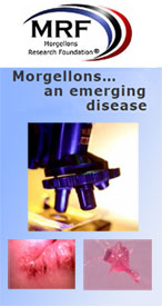 Cover of an MRF brochure: Morgellons… an emerging disease, with a microscope and three small clinical thumbnails.
